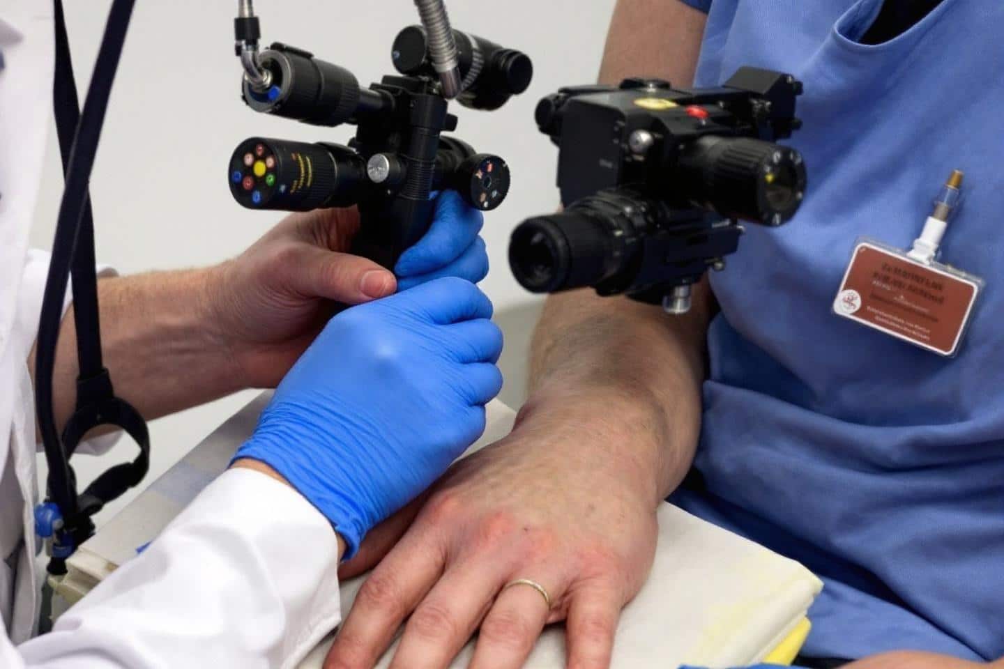 Verrues : Ce que cache leur apparition et comment s’en débarrasser efficacement